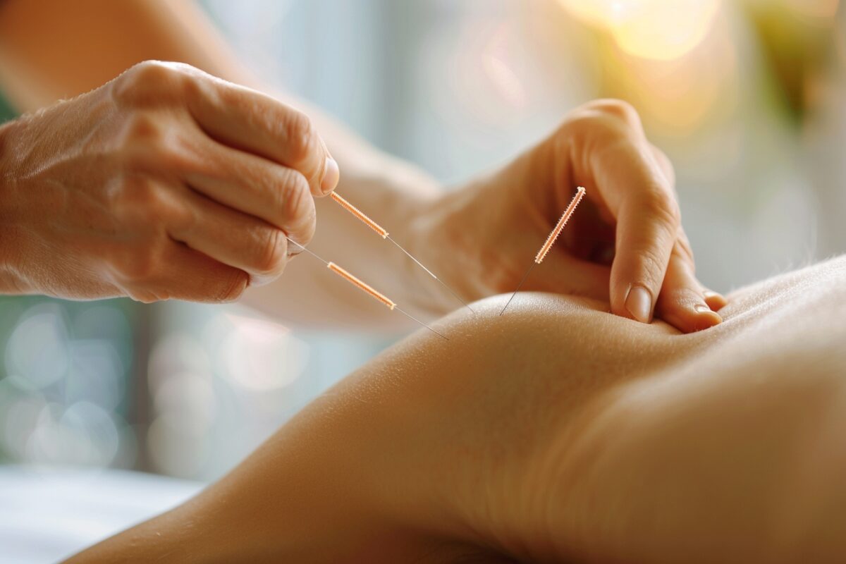 Quels sont les avantages de l'acupuncture dans le traitement des douleurs chroniques ?